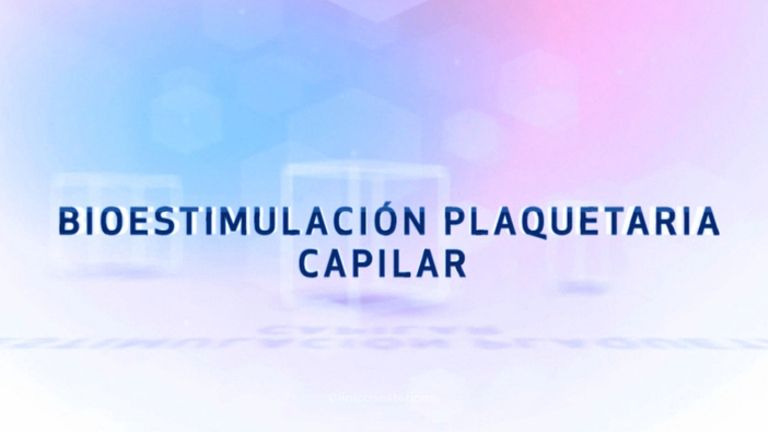 Bioestimulación plaquetaria capilar - Vitaclinic