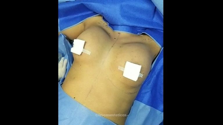 Lipo Clinic By Dr Puchi Clínica De Lipoescultura Hd