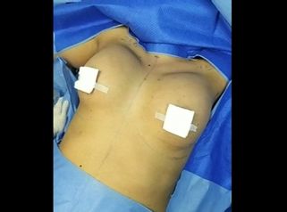 Lipo Clinic By Dr Puchi Clínica De Lipoescultura Hd