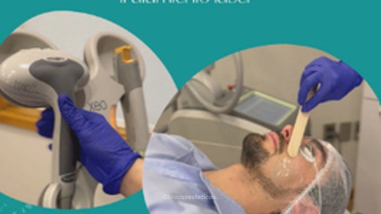 Rejuvenecimiento Facial Láser TItan para Hombres - Centro Médico La Cumbre