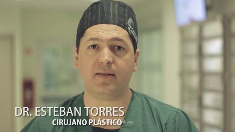 Liposucción realizada por el Dr. Esteban Torres Egaña 