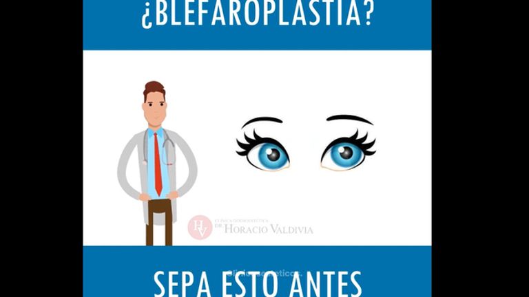 Blefaroplastia - Doctor Horacio Valdivia Meza
