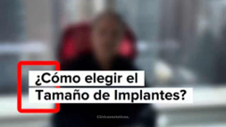 Como elegir el tamaño de implantes? - Dr. Vicente Sánchez Liberona
