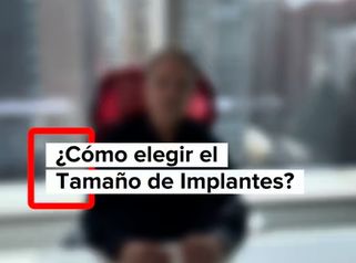 Como elegir el tamaño de implantes? - Dr. Vicente Sánchez Liberona