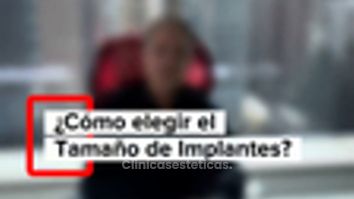 Como elegir el tamaño de implantes? - Dr. Vicente Sánchez Liberona