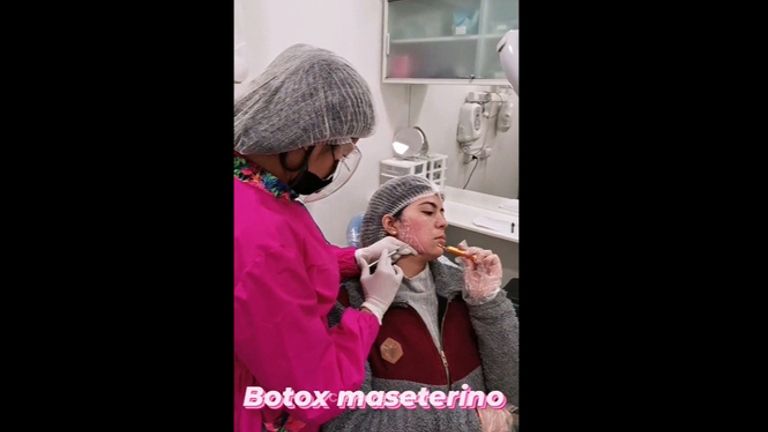 Bótox - Dra. Katherin Ruiz Márquez