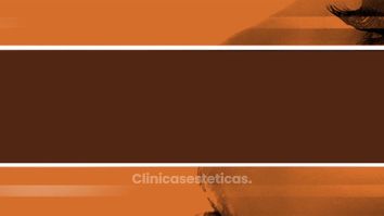 Rinoplastia - Doctor Patricio Stevens Moya