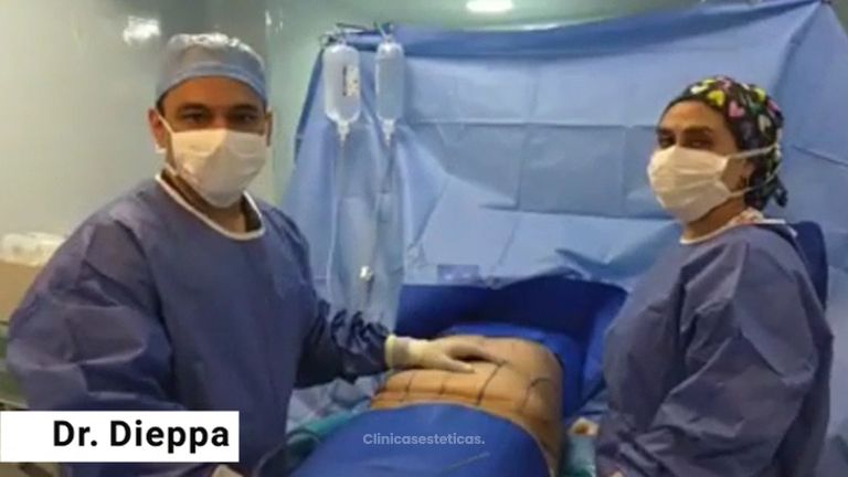 Lipoabdominoplastia y pexia mamaria