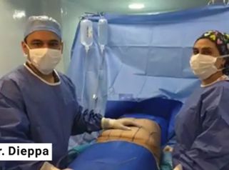 Lipoabdominoplastia y pexia mamaria