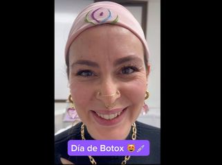 Bótox - Medicina Estética Integral MD