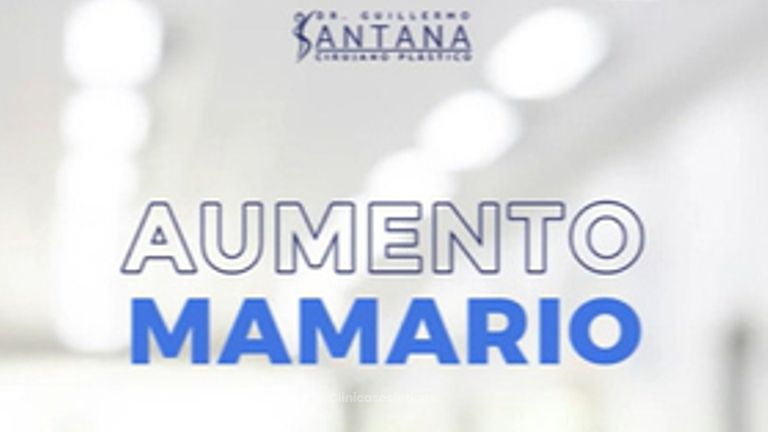 Aumento Mamario - Dr. Guillermo Santana