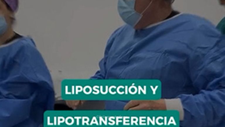Combinación Liposucción y Lipotransferencia glútea - Dr. René Flores Aqueveque