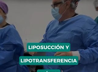 Combinación Liposucción y Lipotransferencia glútea - Dr. René Flores Aqueveque