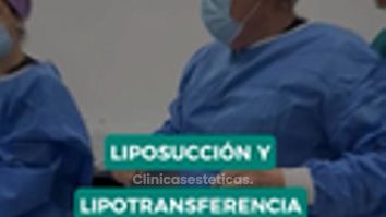 Combinación Liposucción y Lipotransferencia glútea - Dr. René Flores Aqueveque