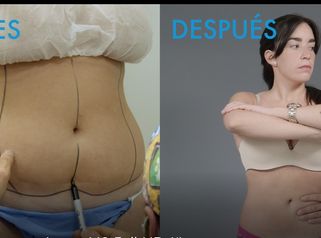 Tratamientos Clinica Renacent