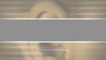 Otoplastia - Doctor Patricio Stevens Moya