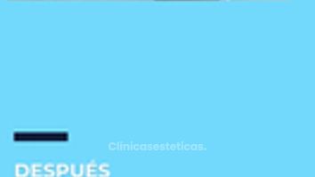 Minilipo - Clinica Bendov