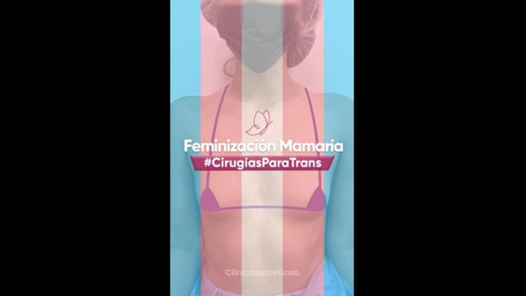 Feminización mamaria - Clínica Anastasia