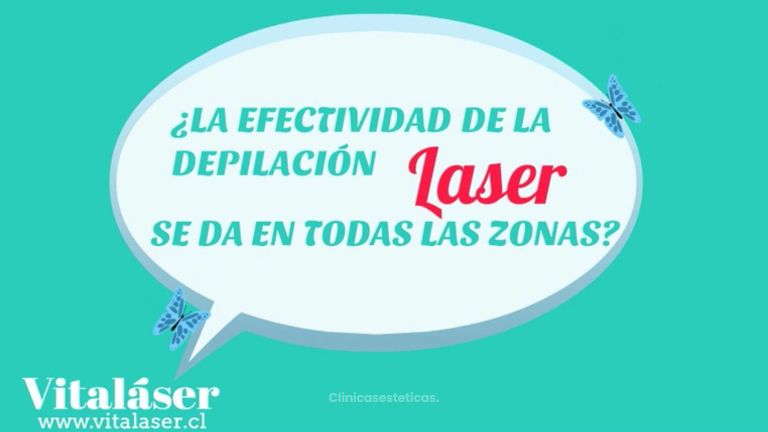 Efectividad de la depilación láser definitiva.