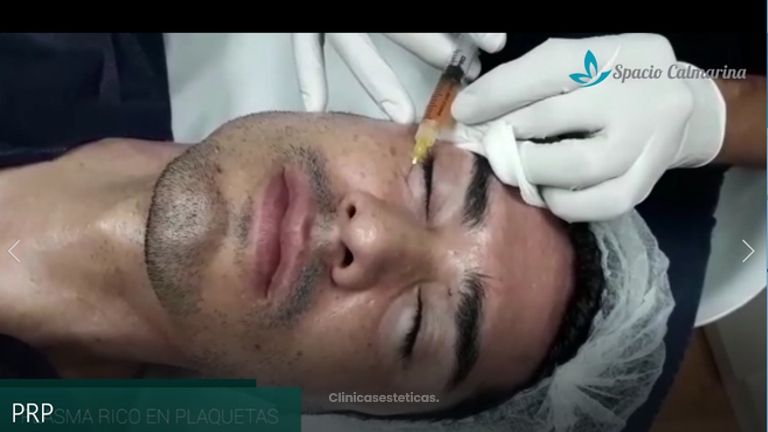 Plasma rico en plaquetas