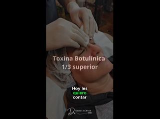 Toxina Botulínica - Dr. Georg Hübner Arancibia