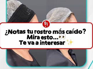¿Notas tu rostro más caido?