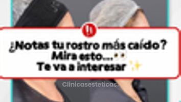 ¿Notas tu rostro más caido?