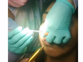 Tratamiento Facial