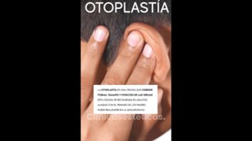 Otoplastia - Clínica de la Figura