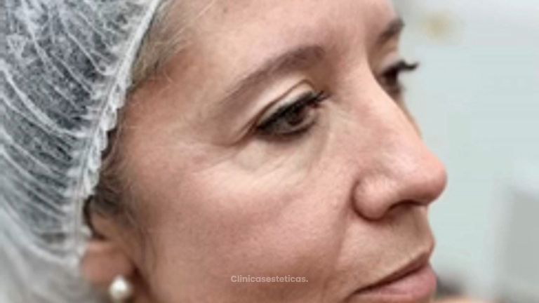 Armonización Facial -Clínica Visage