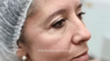 Armonización Facial -Clínica Visage