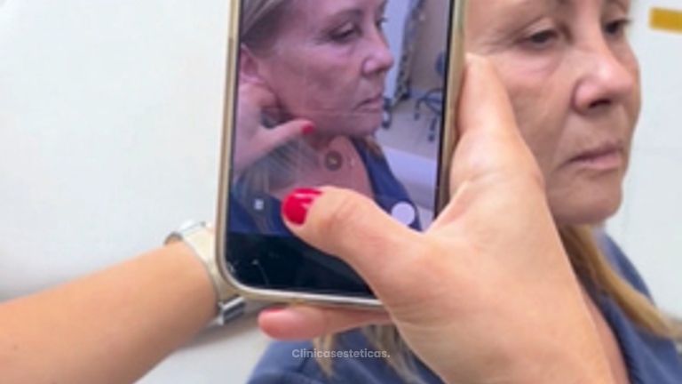 Armonización Facial - Clínica Visage