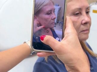 Armonización Facial - Clínica Visage