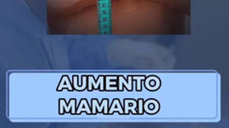 Aumento mamario - Dr. Luis Jaramillo Rojas