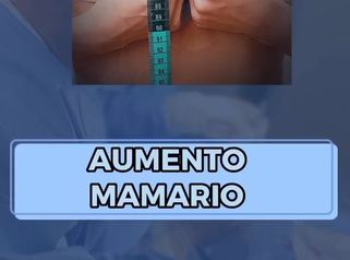 Aumento mamario - Dr. Luis Jaramillo Rojas