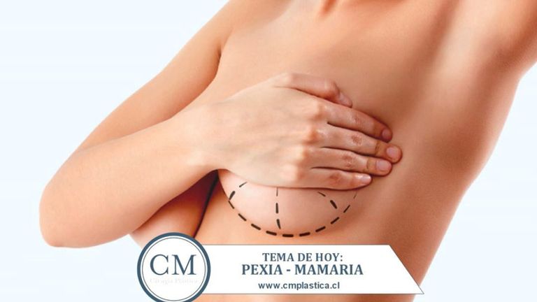 Pexia mamaria