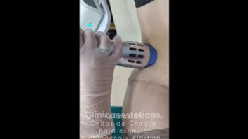 Ondas de choque - Viveclinic