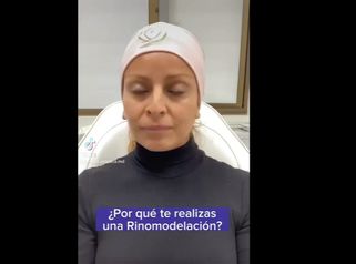 ¿Por qué te realizas una Rinomodelación? - Medicina Estetica Integral MD