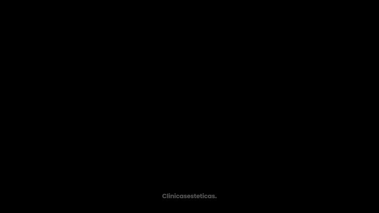 PREGUNTAS EXPLANTACION DR VICENTE