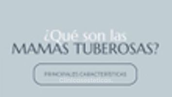 Mamas tuberosas - Dr. Nadir Carda