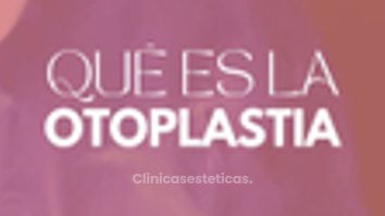 Otoplastia - Dra. Fernanda Deichler