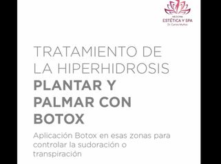Tratamiento de la Hiperhidrosis Plantar y Palmar con Botox