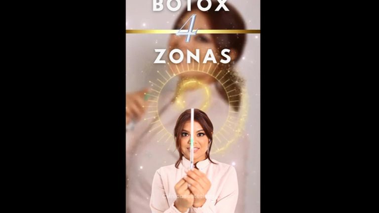 Botox 4 zonas - Dra. Katherin Ruiz Márquez