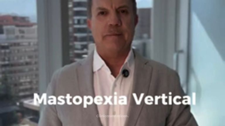 Mastopexia vertical - Dr. Vicente Sánchez Liberona