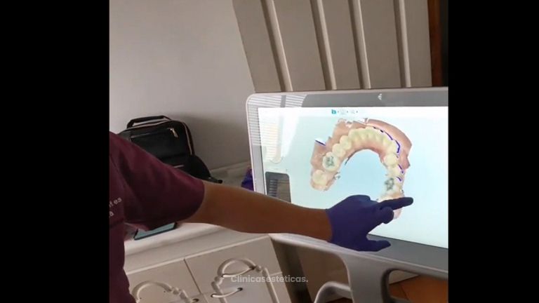 Escáner dental - Centro Dental Santa Teresita Quilpue