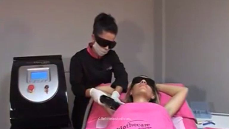 Elimina el vello de forma segura para siempre