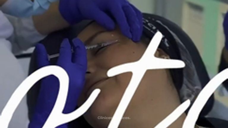 Botox - Clinica Visage