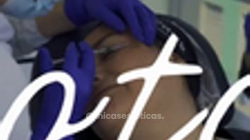 Botox - Clinica Visage