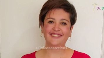 Testimonial - Reducción Mamaria + Abdominoplastia + Lipotransferencia - Dr. Dieppa