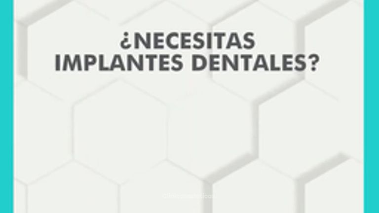 Implantes dentales - Clínica Visage